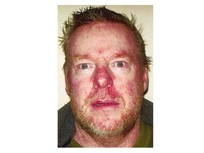 Shane Metcalfe was reported as an unauthorized absence from the Forensic Psychiatric Institute, and is now wanted on a Canada wide warrant for being unlawfully at large. (Coquitlam RCMP photo)
