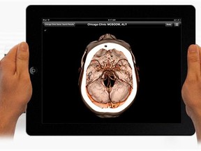 ResolutionMD is a new mobile application developed here in Calgary that lets health care providers securely review high quality medical images on a smartphone, tablet or PC.