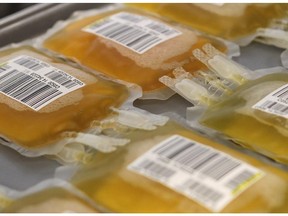 Bags of plasma wait for processing in the lab of the Canadian Blood Service Calgary office on October 29, 2014.