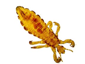 A Photomicrograph shows Pediculus humanus humanus, the common body louse (lice).  New strains are becoming harder to treat. Photo: Fotolia