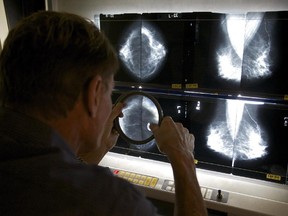 In this photo taken on May. 6, 2010, A radiologist, checks mammograms. Patients and doctors should discuss the risks and benefits of all tests.