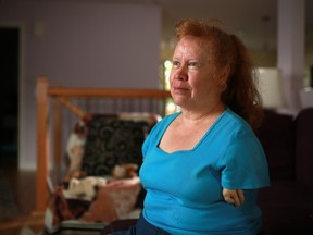 Thalidomide survivor Marie Olney was photographed in her Calgary home. The federal government has announced how their compensation packages for Canada's Thalidomide survivors will work.