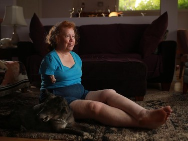 Thalidomide survivor Marie Olney was photographed with her dog Lennox in her Calgary home. The federal government has announced how their compensation packages for Canada's Thalidomide survivors will work.