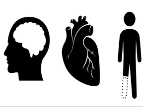 Cardiovascular Disease can manifest in many ways – including Stroke, Heart Attack, and Peripheral Vascular Disease – and causes loss of life and limb.