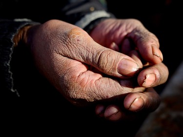 Hands of A homeless man in Calgary on December 13, 2015.