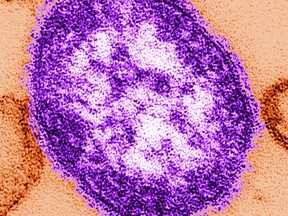 This image from the U.S.  Centers for Disease Control and Prevention shows an electron microscope image of a measles virus particle, center. Measles is considered one of the most infectious diseases known. The virus is spread through the air when someone infected coughs or sneezes.