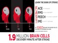 Stroke is a time-critical emergency: “time is brain”. Integrated systems of stroke care seek to optimize the continuum of stroke care from prevention through to rehabilitation – and they save lives.