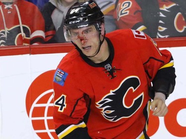 Calgary Flames Garnet Hathaway skates away bloody after tangling with San Jose Sharks Brent Burns in NHL hockey action at the Scotiabank Saddledome in Calgary, Alta. on Monday March 7, 2016. Mike Drew/Postmedia