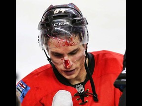 Calgary Flames Garnet Hathaway heads to the dressing room after a fight with Brent Burns of the San Jose Sharks during NHL hockey in Calgary, Alta., on Monday, March 7, 2016. AL CHAREST/POSTMEDIA