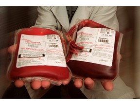 Mike Mainville, a Lab Assistant at Canadian Blood Services holds two units of O positive blood.