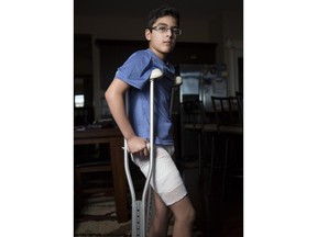 Ali Hassan, 12, sits in his home with his bandage wrapped leg in Aspen Calgary, on April 1, 2016. Hassan was badly bitten by a police dog outside his home on March 30.
