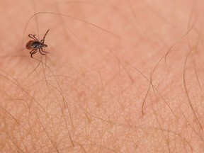 Close-up of a tick on someone's skin.