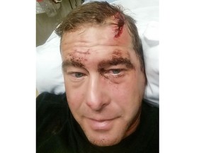 Christopher Darryl was brutally beaten by four men, including one with a baseball bat, outside his home in Calgary. Supplied