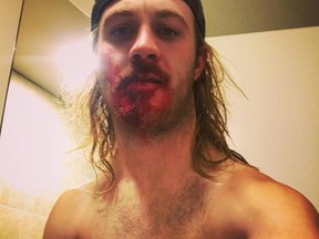 Lethbridge resident Alex Hamilton alleged in a Facebook post that he was assaulted by Lethbridge police officers.