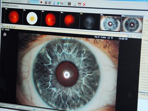 Retinal scans detecting early signs of damage due to diabetes.