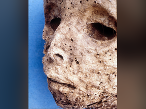 The mummified remains of a small child buried in the Basilica of Saint Domenico Maggiore in Naples, Italy. An earlier analysis suggested the child died of smallpox because of scars on its face.