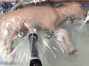 fluid-filled incubation system that mimics a mother’s womb, in hopes of one day improving survival of extremely premature babies. In animal testing, fetal lambs grew for up to four weeks inside a bag filled with a substitute for amniotic fluid