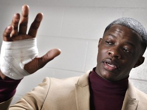 James Shaw Jr. shows his hand that was injured when he disarmed a shooter inside a Waffle House on Sunday, April 22, 2018, in Nashville, Tenn. A gunman stormed the Waffle House restaurant and shot several people to death before dawn, according to police, who credited Shaw, a customer, with saving lives by wresting the assailant's weapon away.