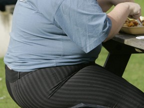 A new study shows overweight people have smaller brains than those of a regular weight.