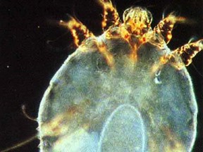 Scabies is a tiny mite that can cause skin ailments. File photo