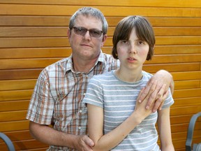Ian Menzies poses with his 19-year-old daughter Keira at their family home in Calgary on July 11, 2019. Keira is autistic and depends on a unique summer day camp for her development. For the first time in 11 years, she has been rejected for funding to access the camp. Jim Wells/Postmedia