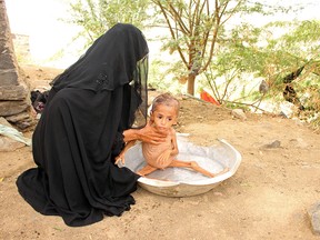 Mother of malnourished Muath Ali Muhammad washes him near their home in Aslam district of the northwestern province of Hajja, Yemen July 30, 2019. Picture taken July 30, 2019. REUTERS/Eissa Alragehi  NO RESALES. NO ARCHIVES. ORG XMIT: HFS-GGGKHA15