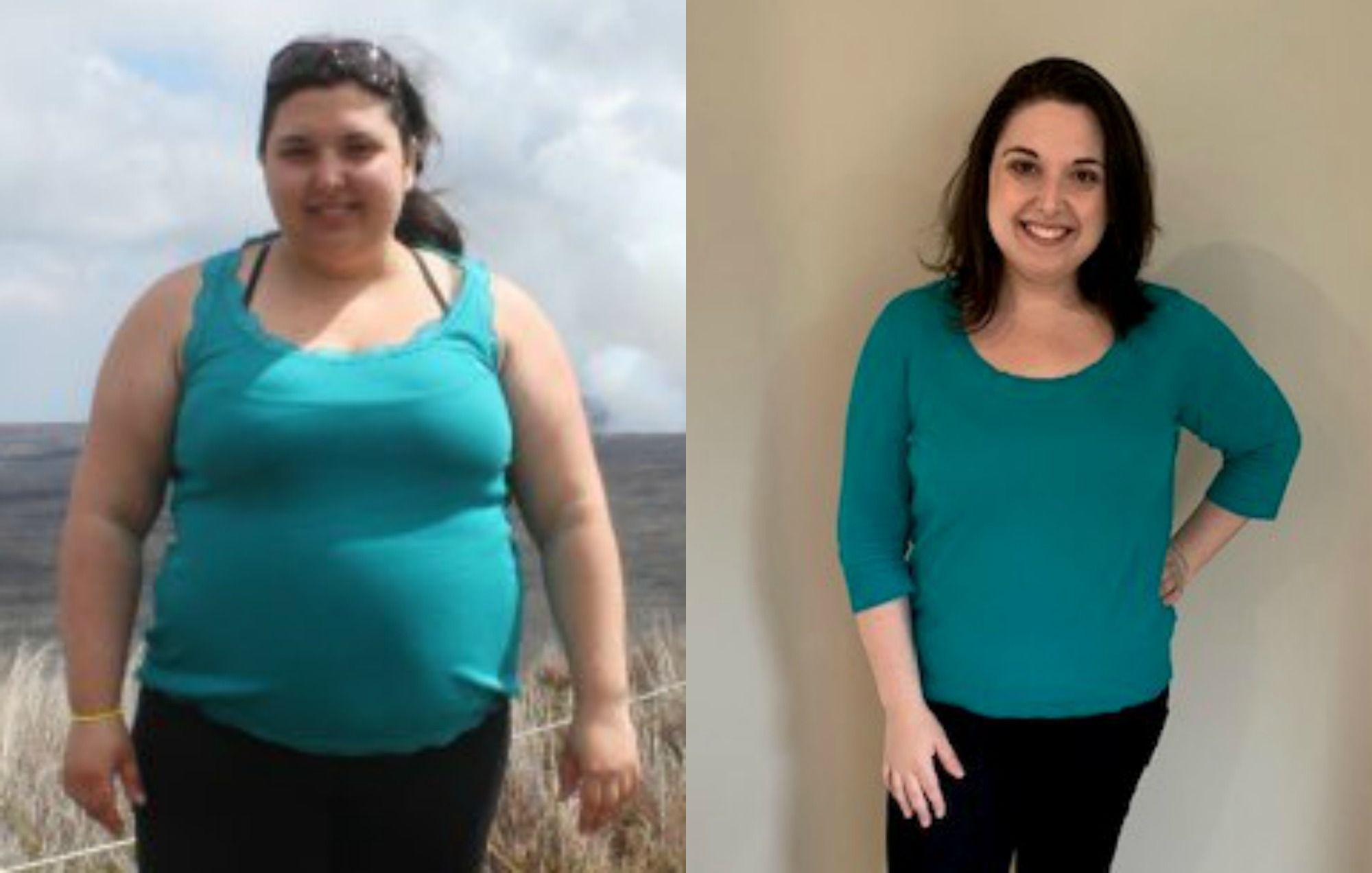 Sponsored Janna gets her life back with weight loss surgery Calgary