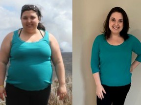 Janna loses over 100 pounds with her Mini Gastric Bypass procedure.