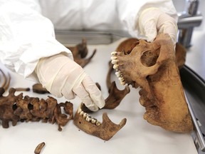 FILE PHOTO: A forensic doctor examines the bones of an unidentified victim which is analyzed in the lab of the Attorney-General's office in Bogota, Colombia, July 21, 2015. REUTERS/Jose Miguel Gomez/File Photo ORG XMIT: FW1