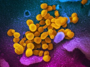 This undated electron microscope image made available by the U.S. National Institutes of Health in February 2020 shows the Novel Coronavirus SARS-CoV-2, yellow, emerging from the surface of cells, blue/pink, cultured in the lab. Also known as 2019-nCoV, the virus causes COVID-19.