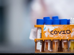 Specimens to be tested for COVID-19 are seen at a LifeLabs laboratory in Surrey, B.C., on March 26, 2020.