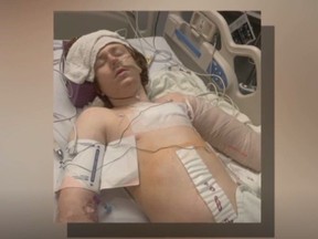 Linden Cameron, 13, is pictured in the hospital after he was shot by Salt Lake police.