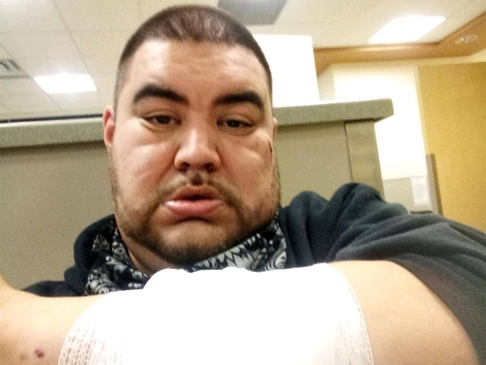 'Racism is still out there': Indigenous couple report being rear-ended, assaulted in Airdrie