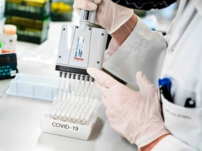 Researchers at Aalborg University screen and analyze all positive Danish coronavirus samples for the virus variant cluster B117 from the United Kingdom, in Aalborg, Denmark on January 15, 2021, during the ongoing novel coronavirus (Covid-19) pandemic.
