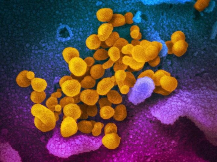  Electron microscope image made available by the U.S. National Institutes of Health in Feb. 2020 shows the Novel Coronavirus SARS-CoV-2, yellow, emerging from the surface of cells, blue/pink