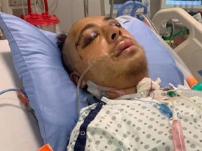 Michael Richards is in critical care due to serious head trauma sustained during a series of violent assaults in downtown Calgary. The assaults took place on Oct. 15, 2021.