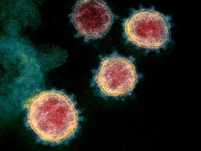 SARS-CoV-2, also known as the novel coronavirus that causes Covid-19, isolated from a patient in the U.S.