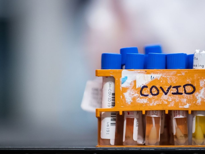  Specimens to be tested for COVID-19 are seen at LifeLabs in Surrey, B.C., on March 26, 2020.