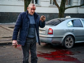 An injured man stands on a street after Russian shelling to the Ukrainian city of Kherson on December 24, 2022, where five were killed and 20 injured.