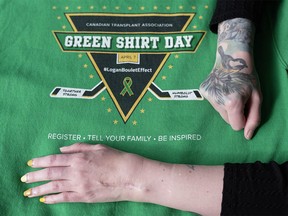 Brandy Hehn, 39, displays a large scar on her wrist at her home in Regina on Thursday, March 16, 2023. Four months after her 2009 liver transplant, Hehn developed a staph infection in her wrist due to her weakened immune system from the transplant medication resulting in surgery and the scar. The two-time organ recipient designed this year’s Green Shirt Day logo for the five-year anniversary of the Humboldt Broncos bus crash.
