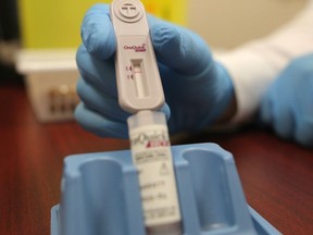 A hepatitis C screening called OraQuick HCV rapid antibody test is administered at London Drugs in Calgary on Jan. 29, 2019.