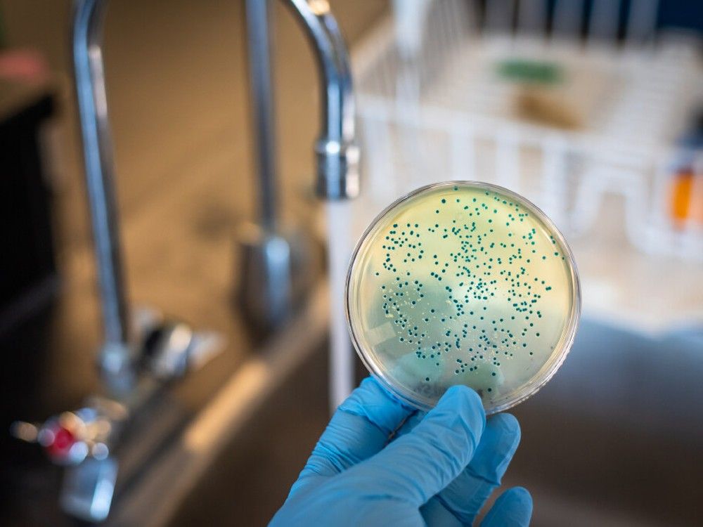 Illustration shows E.coli bacterial cultures in petri dishes