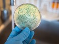 E. coli outbreak Calgary daycares