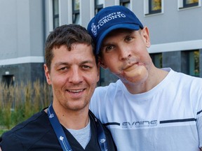 Dr. Oleksa Rewa, an ICU surgeon at the University of Alberta hospital poses with a Ukraine war victim that he performed surgery on in a mission with the Canada-Ukraine Foundation that helps warm victims receive life-changing plastic surgeries.