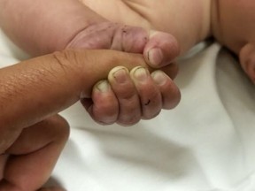 This Sunday, July 8, 2018 photo provided by the Missoula County Sheriff's Office shows a 5-month-old infant with dirt under their fingernails after authorities say the baby survived about nine hours being buried under sticks and debris in the woods.