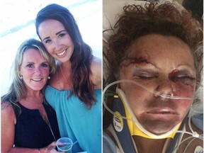 This collage shows Dianne Denovan (left) and her daughter Nikole not long before Dianne was assaulted by her former boyfriend, Michale Richard "Rick" Cole. The photo on the right shows Dianne in hospital after the attack on Oct. 23, 2016.