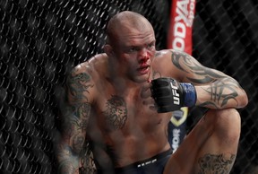 Anthony Smith collects himself after taking a knee to the face during a light heavyweight title bout against Jon Jones during UFC 235 at T-Mobile Arena on March 2, 2019 in Las Vegas.