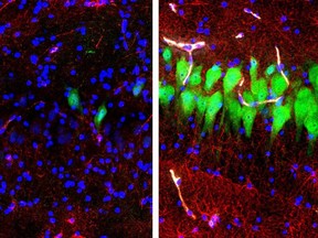 This combination of images provided by the Yale School of Medicine in April 2019 shows stained microscope photos of neurons, green; astrocytes, red, and cell nuclei, blue, from a pig brain left untreated for 10 hours after death, left, and another with a specially designed blood substitute pumped through it. By medical standards "this is not a living brain," said Nenad Sestan of the Yale School of Medicine, one of the researchers reporting the results Wednesday, April 17, 2019, in the journal Nature. But the work revealed a surprising degree of resilience within a brain that has lost its supply of blood and oxygen, he said.