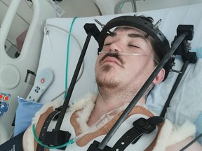 Taber, Alta. crash survivor Dorian Gladue broken both left, part of his pelvis, hips, fractured his neck and is suffering internal bleeding after a two-vehicle crash left four dead and injured many others. Photo courtesy, Heaven Gladue.