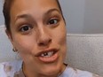 Ashley Graham shows off her broken tooth in a video she posted on Instagram.